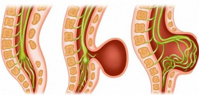 d092a7ea9dcb3e71938975c579e85d9c M