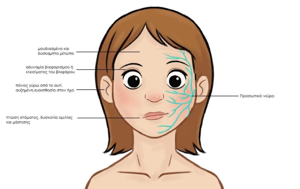 ΠΡΟΣΩΠΙΚΟ ΚΡΑΝΙΑΚΟ ΝΕΥΡΟ