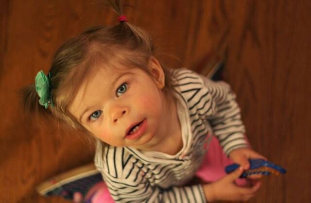 syndromowilliams 640x418